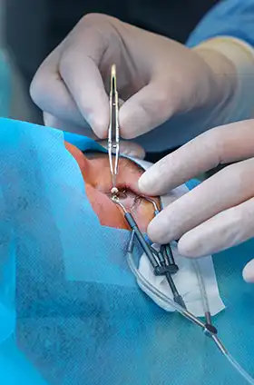 operazione specialista oculista roma