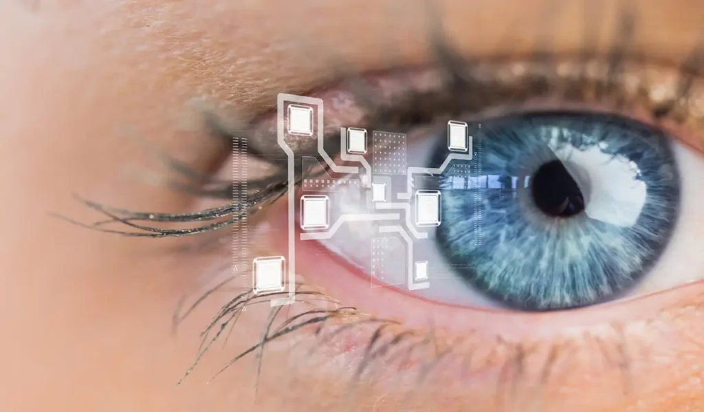 intervento laser occhi